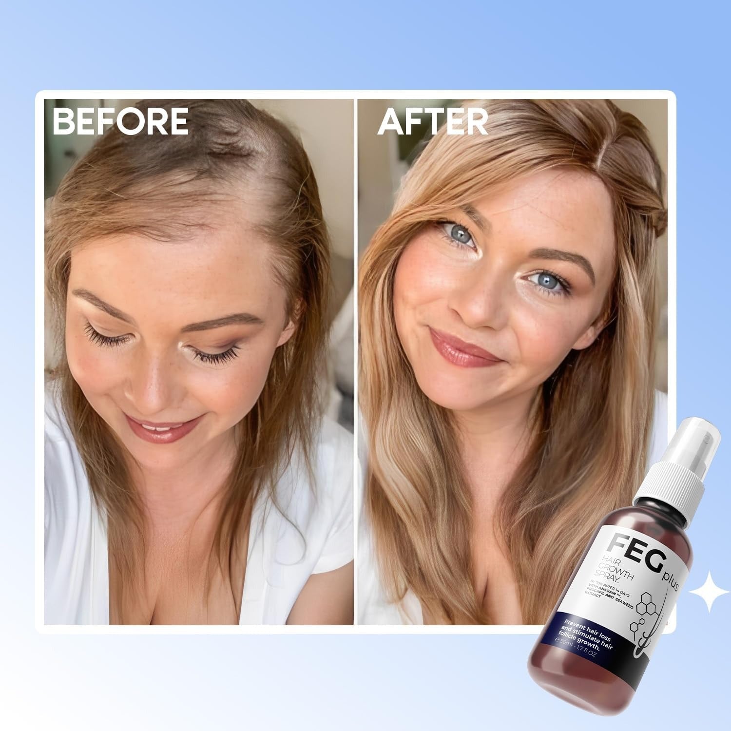 FEGPlus Minoxidil Beard & Hair Growth Serum – 2-5% Strength, 30ml