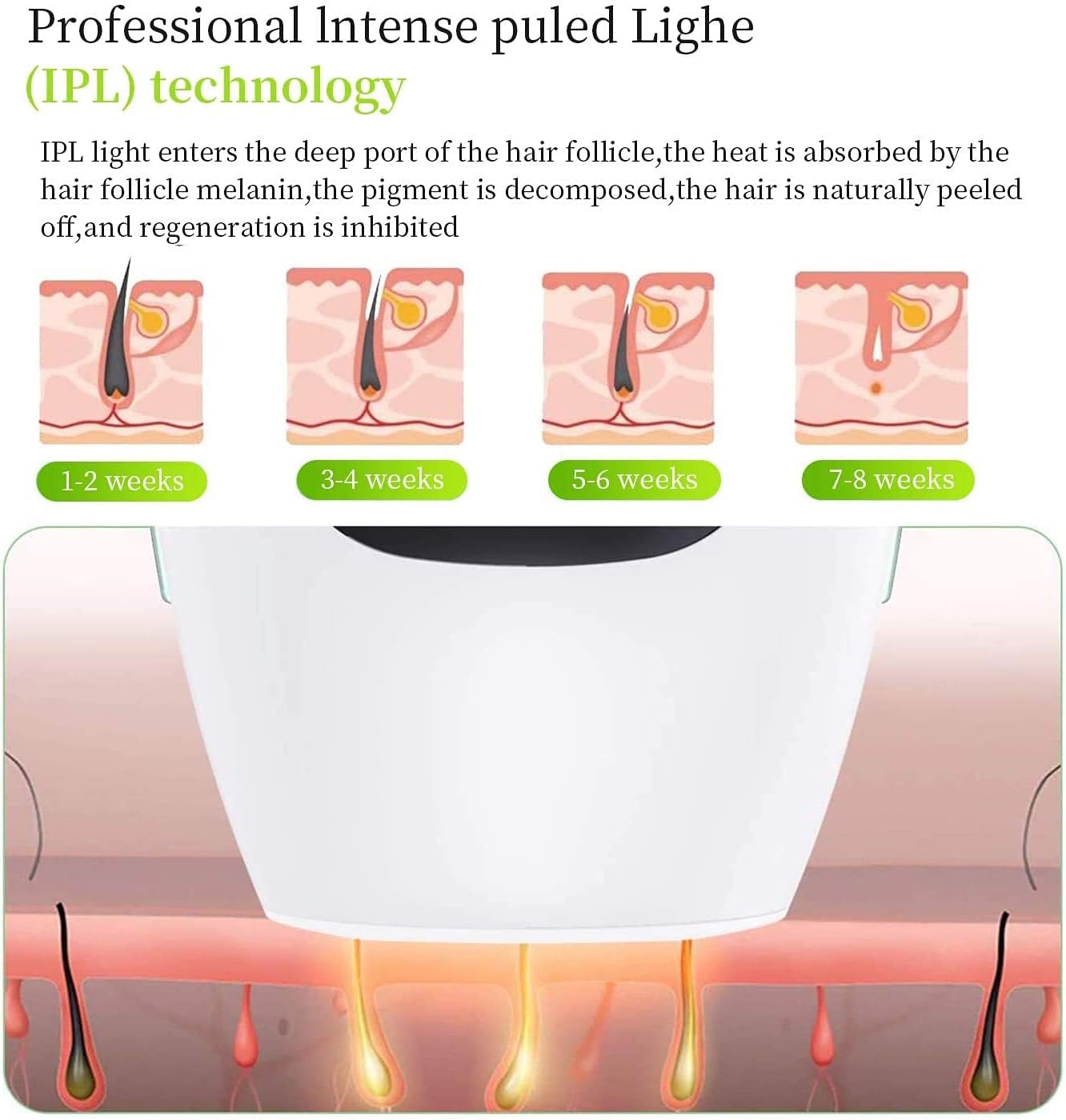 IPL Hair Removal System – Permanent Laser Epilator