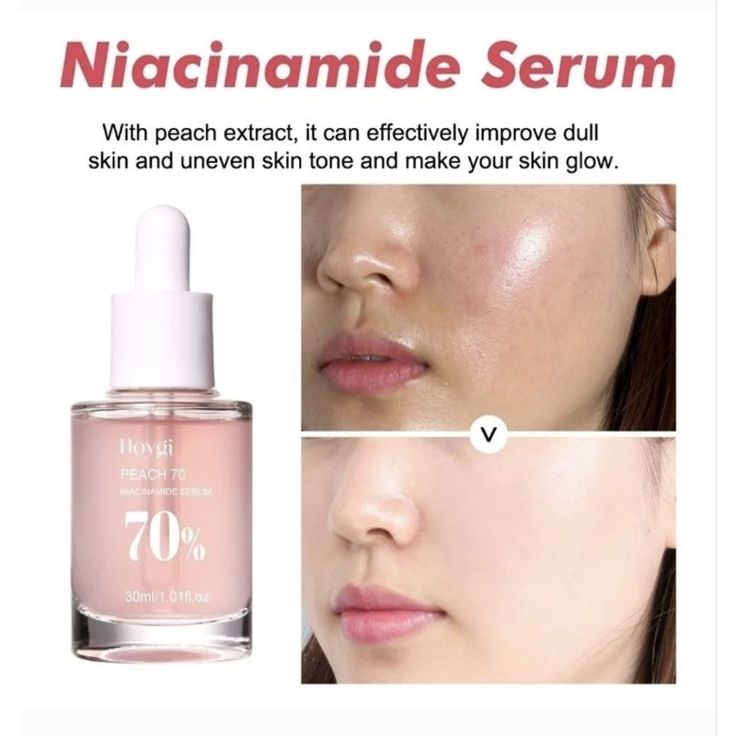 Anua Wonder Peach 70% Niacinamide Serum – Brightening & Hydrating