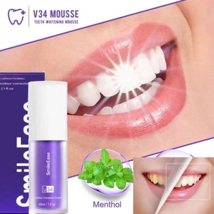 Hismile V34 Colour Corrector – Teeth Brightening